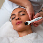 DSC05398-Bearbeitet 1 needling